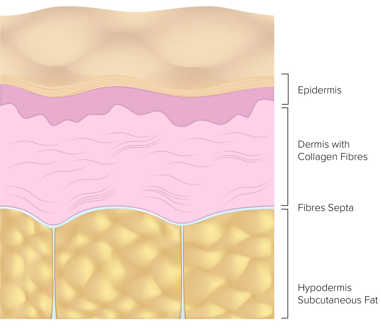 Cellulite Treatment Machines - CliniMed Aesthetics